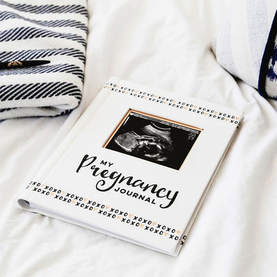 Pearhead Pregnancy journal Black, White & Gold - Molly's Baby Room